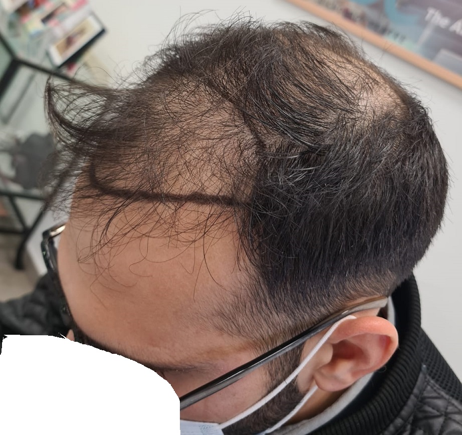 2. Before Left.jpg