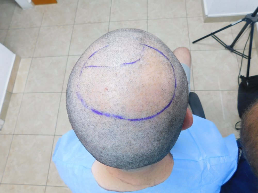 2. Before with Design.JPG