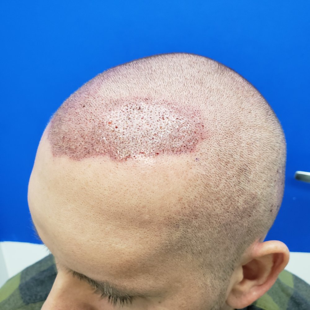 20210327_083414.jpg