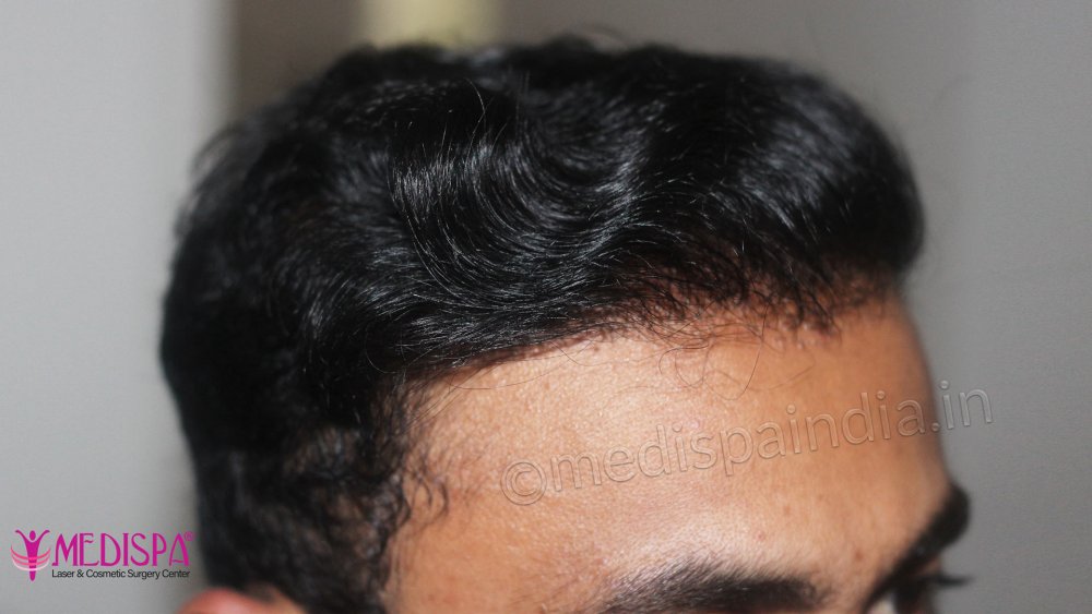 20_side-zoom.jpg