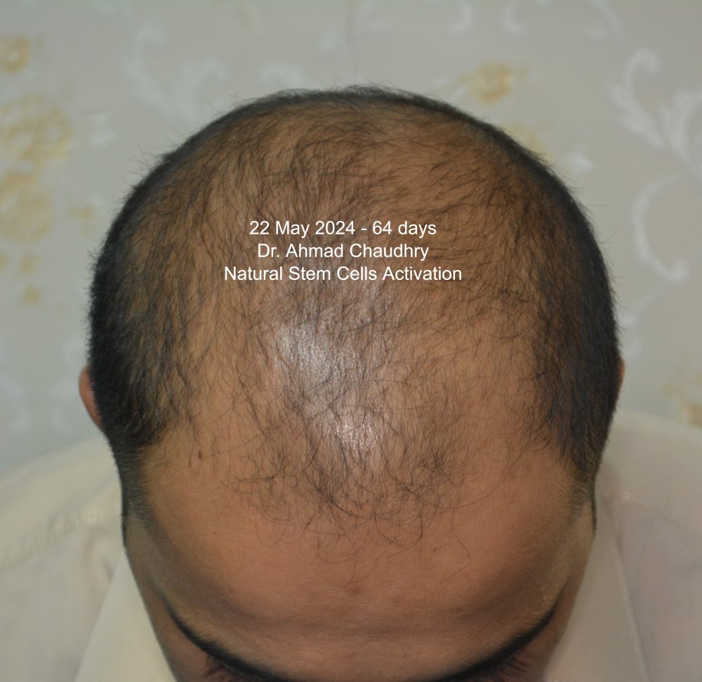 22 May 2024 progress 64 days later.jpg