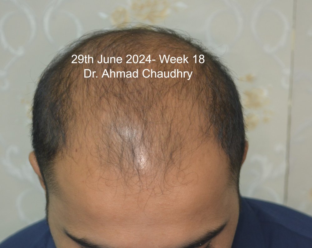 29th June 2024 Results 18 Weeks.jpg