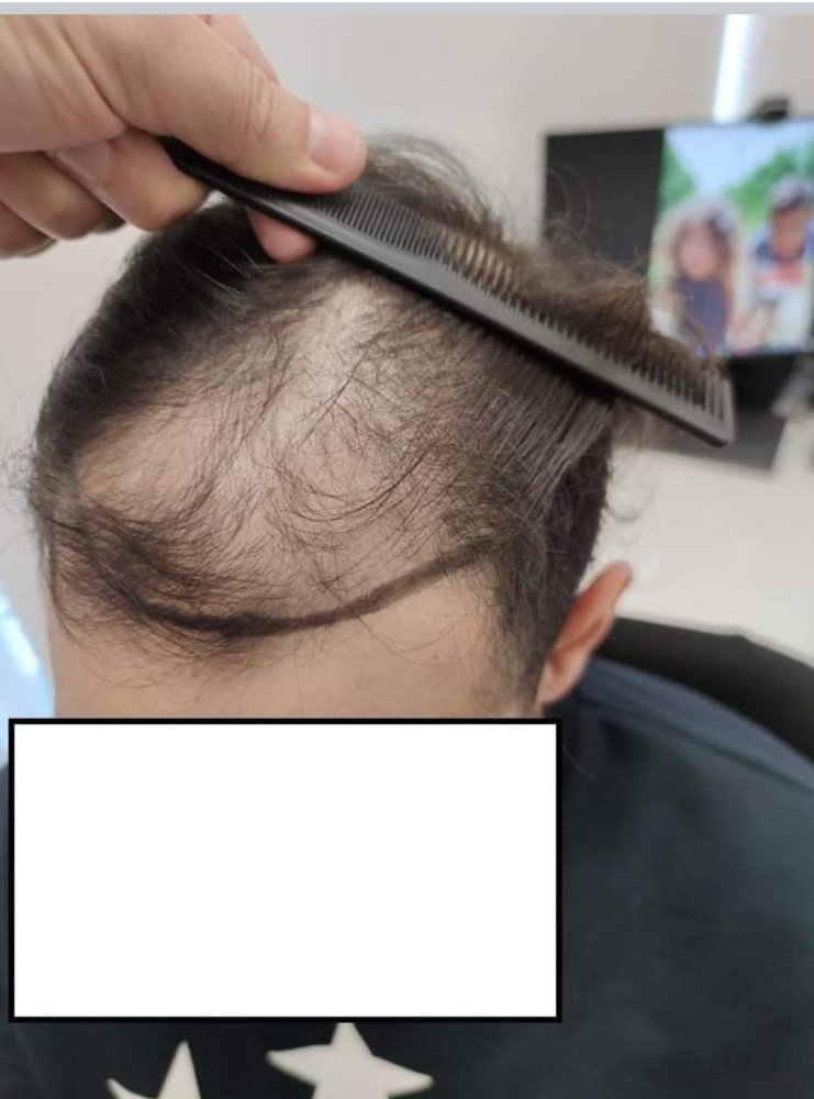 3. Before Left.jpg