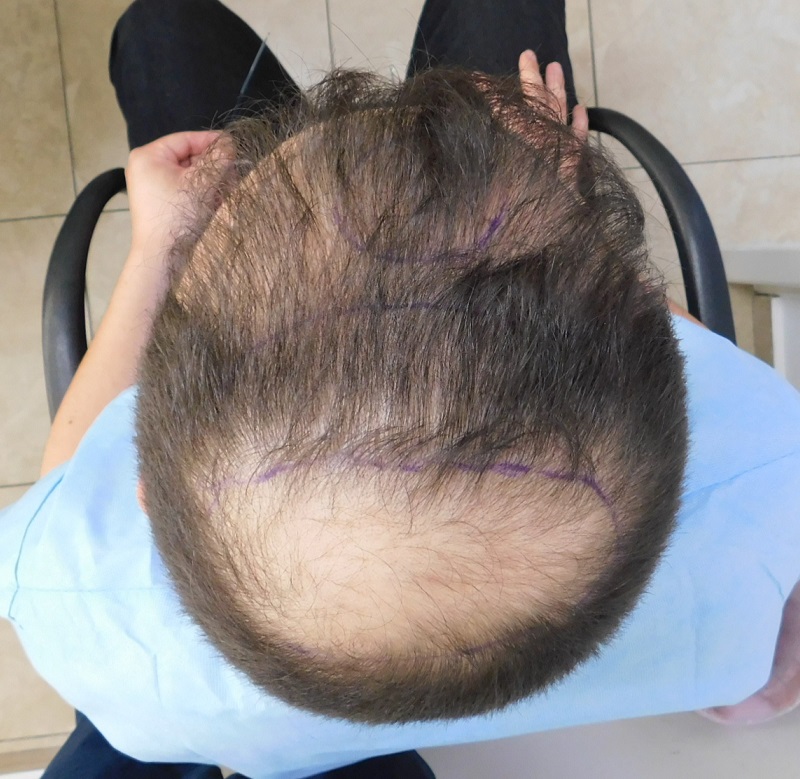 3. Top View of Before.JPG