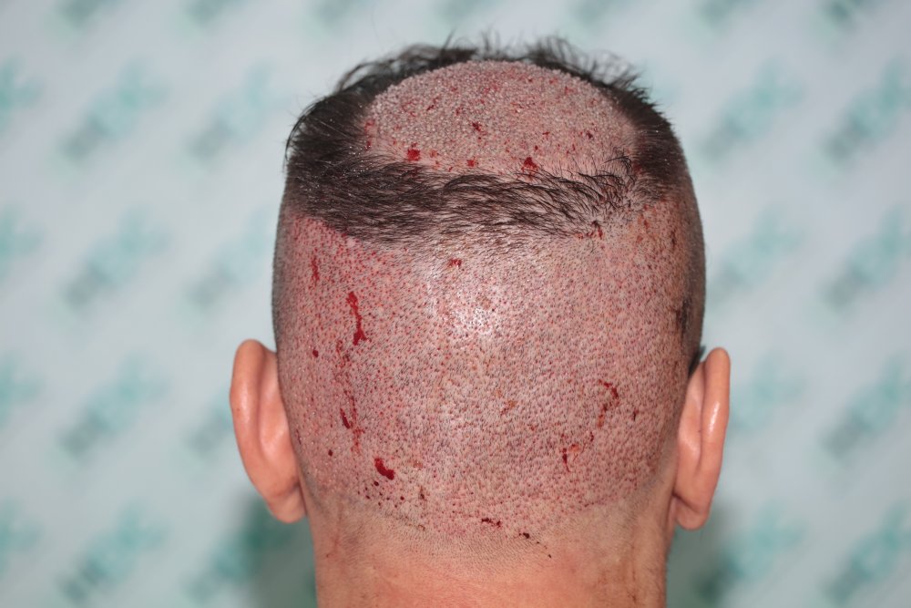 3a. Back Doror Post op.JPG