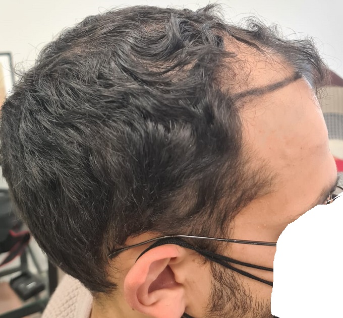 3a. Before Right Side.jpg