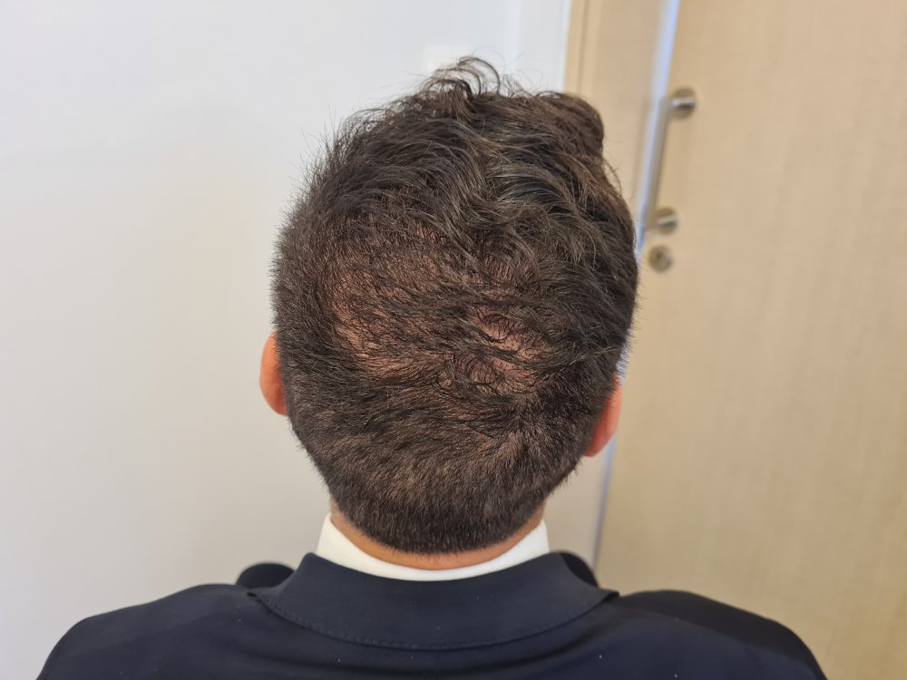 4. 5 months.jpg