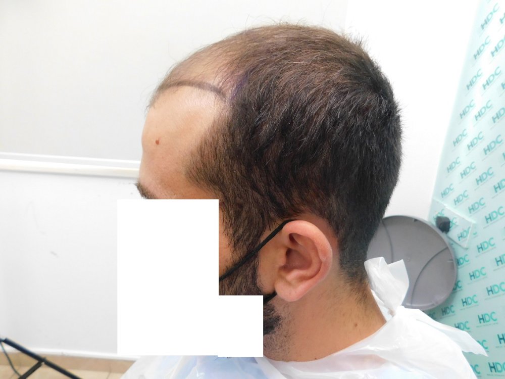 4.Before.JPG