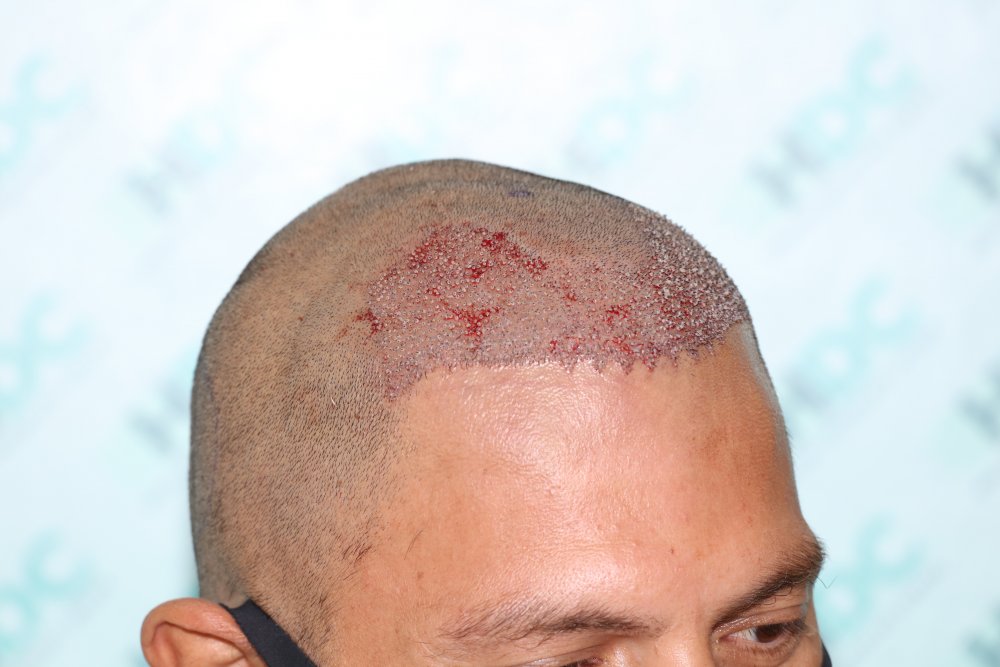 4.JPG