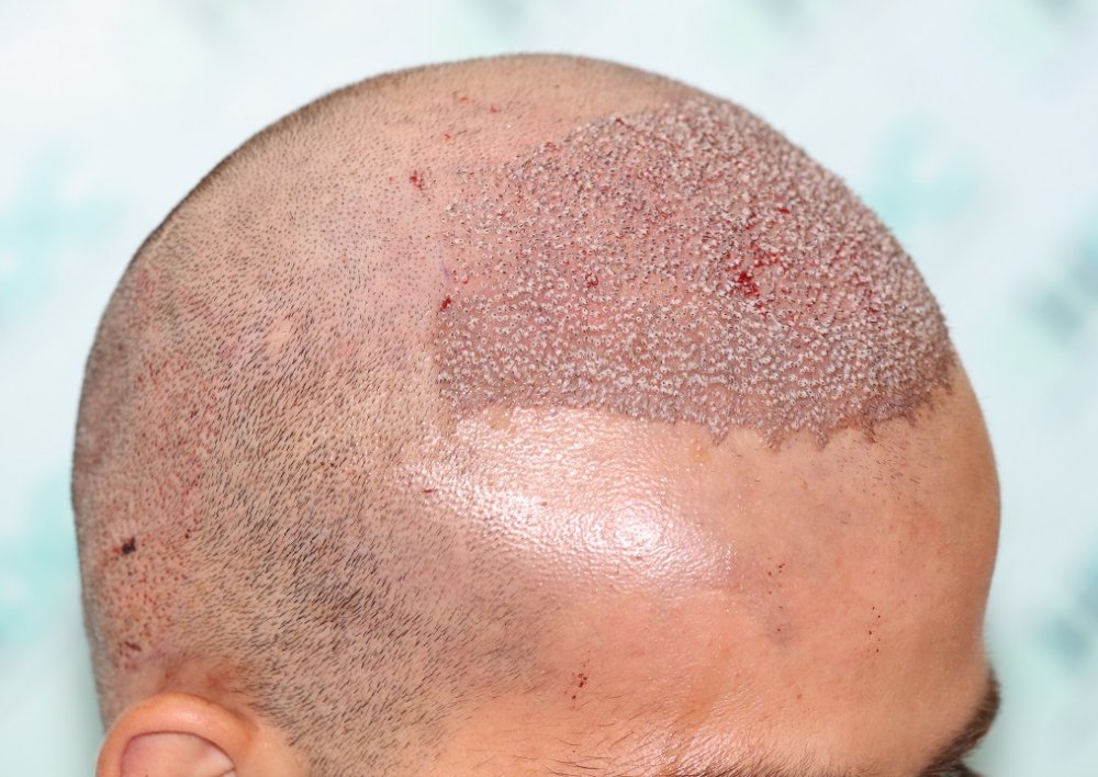 4b. Post op - Right.JPG
