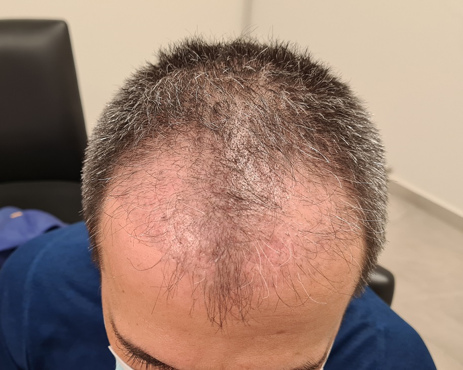 5. 2 months after.jpg