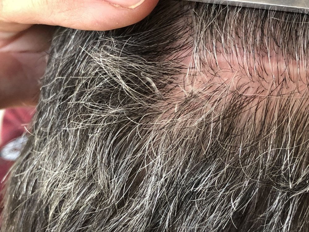 5.5months post & after 2nd Haircut 3131 - left side.JPG