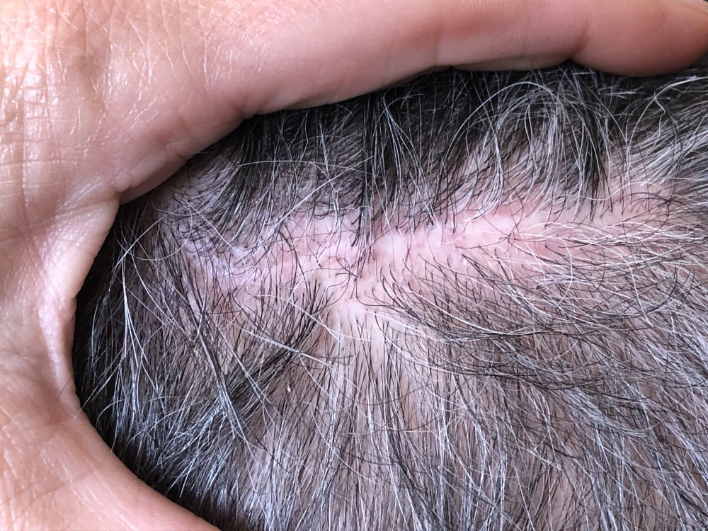 5.5months post & after 2nd Haircut 3135 - rear.JPG