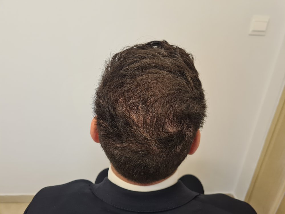 5. 7 months.jpg