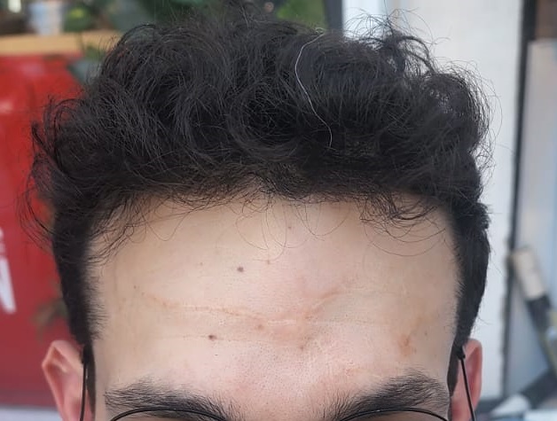 5. After Front.jpg