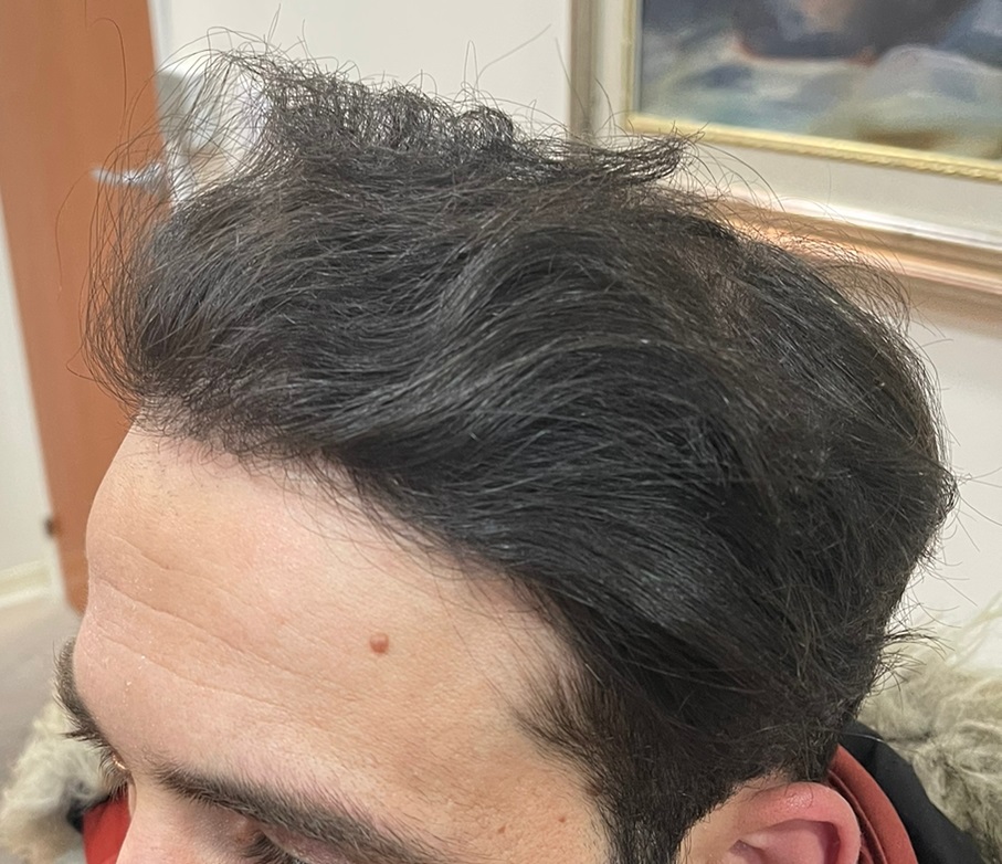 5. After Left.jpg