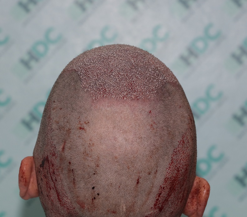 5.JPG