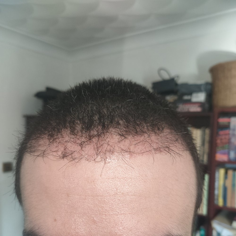 5 weeks front.jpg