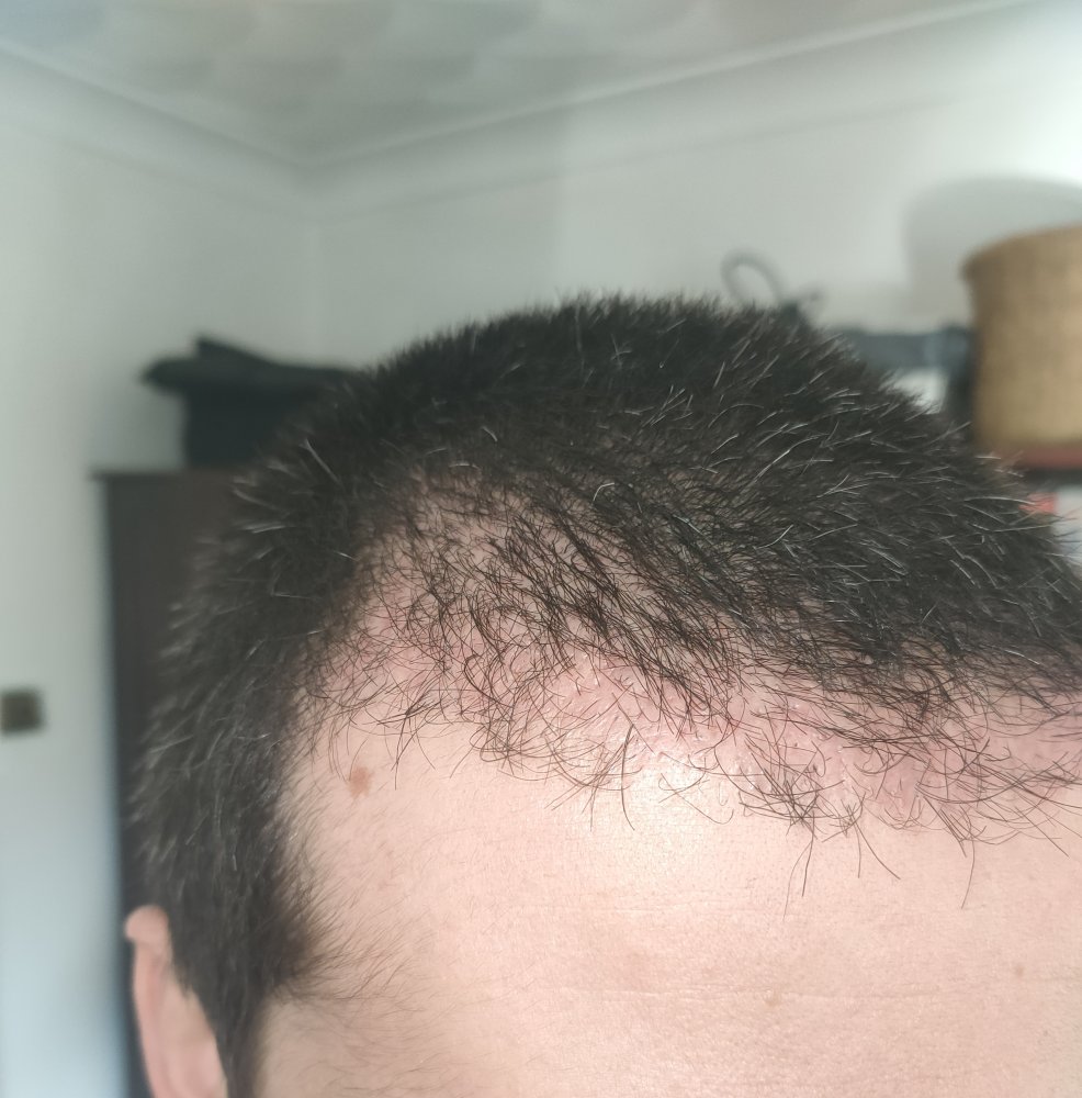 5 weeks right.jpg