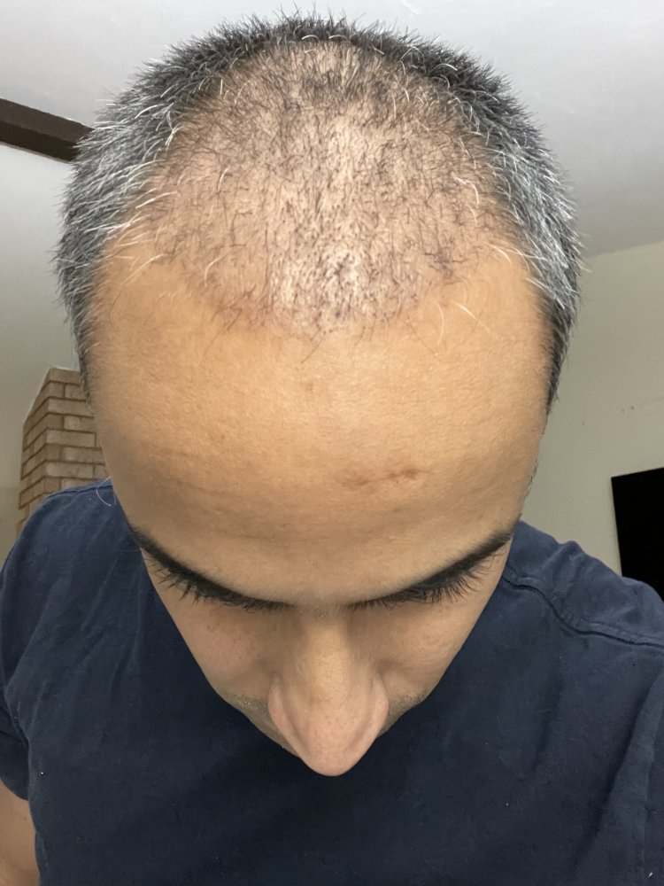 55969A17-203D-433F-86AF-3BDADECC993A.jpeg