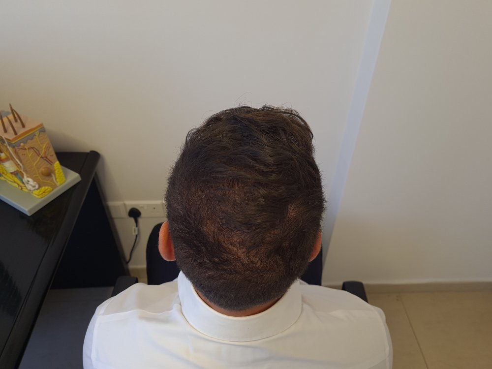 6. 10 months Top View.jpg