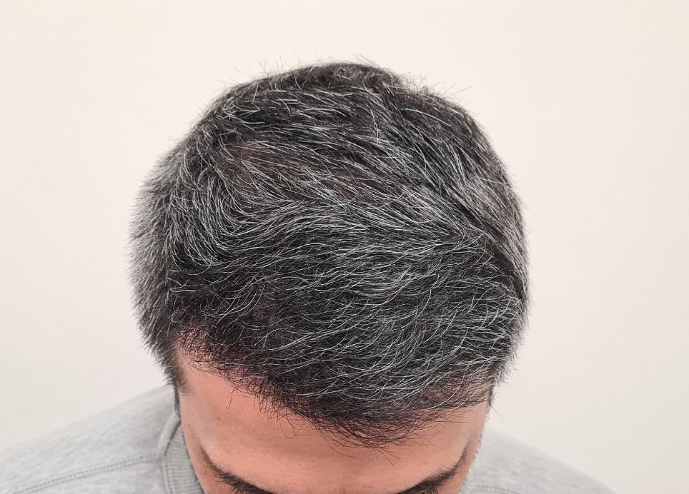 6. 6 Months Top.jpg