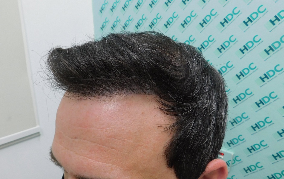 6 - After Front left.JPG