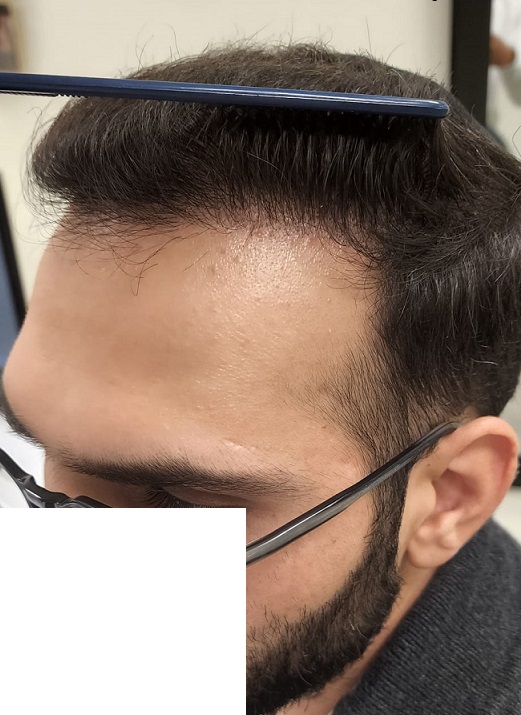 6. After Left.jpg