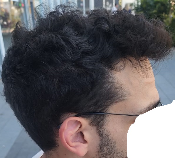 6. After right Side.jpg