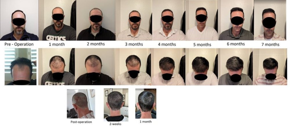 6 . Monthly Evolution of Growth.jpg