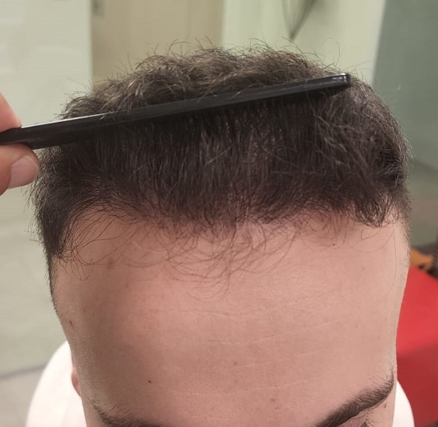 6. Result of Front.jpg