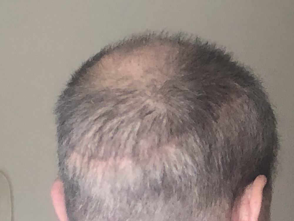 6 weeks post 2719.JPG