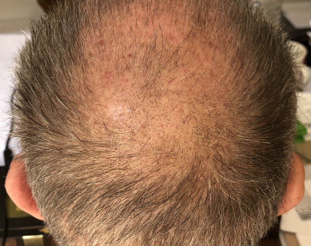 6 weeks post 2753.JPG