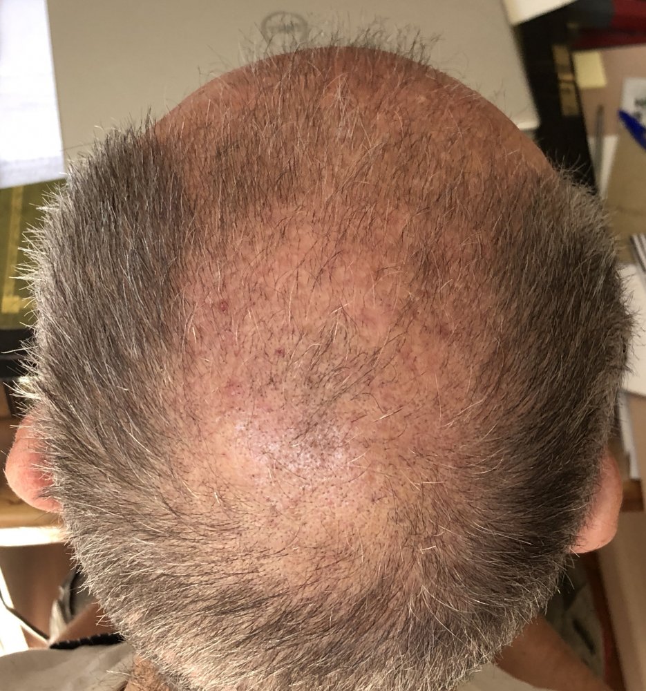 6 weeks post 2755.JPG