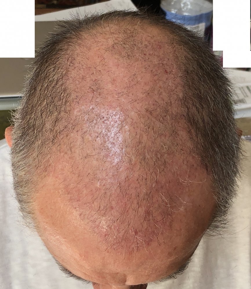 6 weeks post 2762.JPG