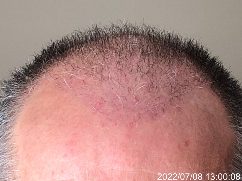 6 weeks post 2766.JPG