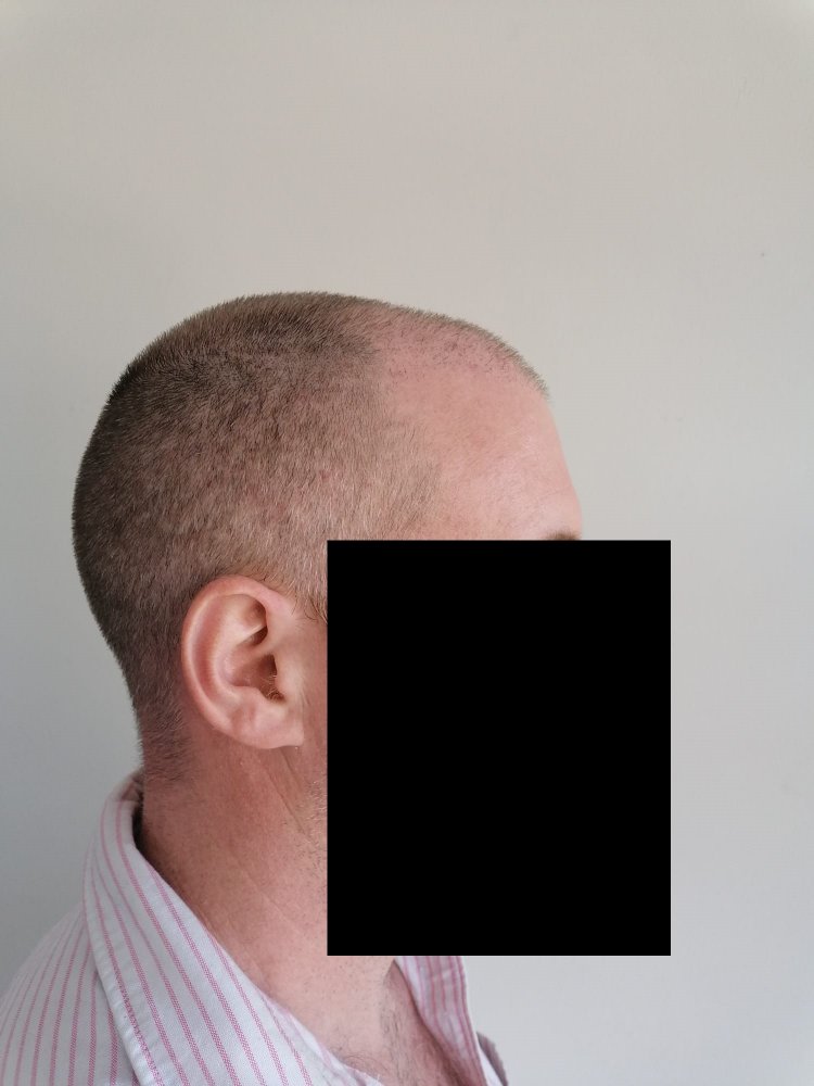 6 weeks right.jpg