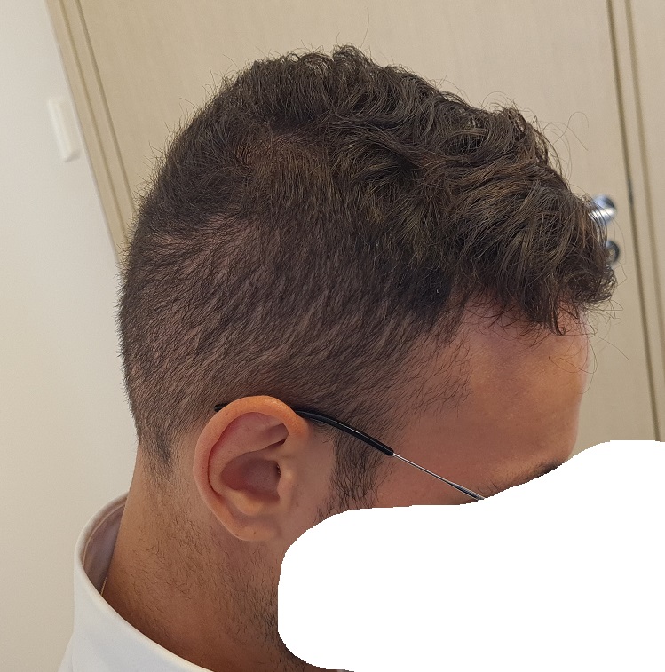 7. 10 months right Side View.jpg