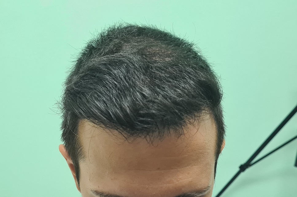 7. 2 years After - Front.jpg