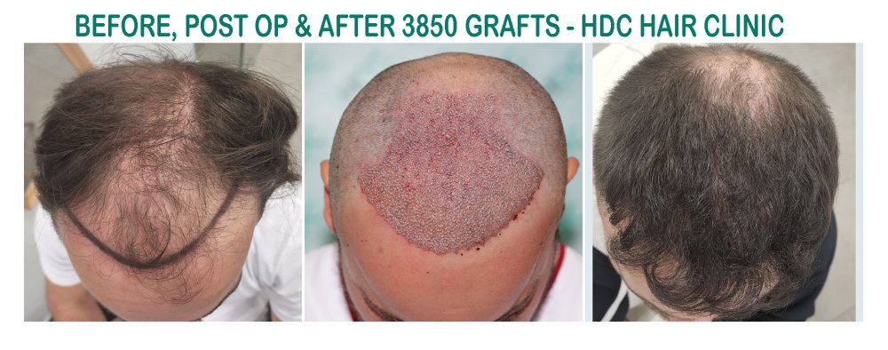 7. 3850 Grafts HT 30-06-22 Set 1.jpg