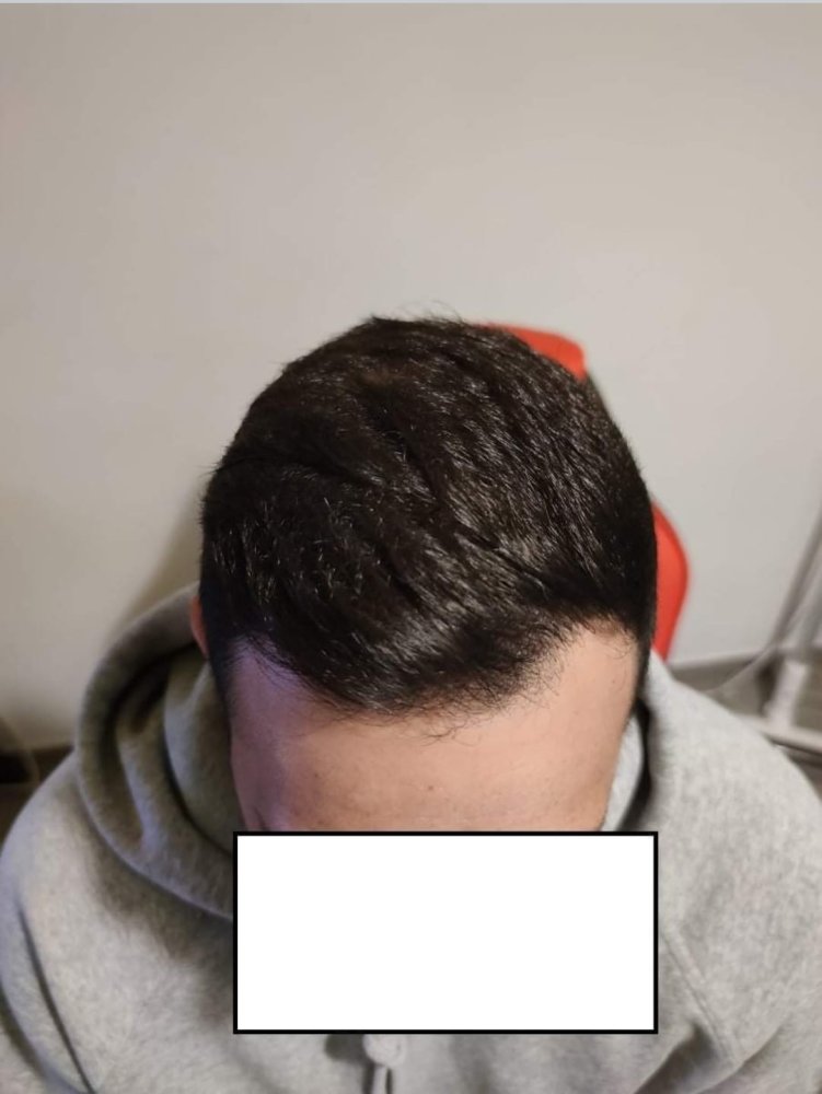 7. After 3 years Front.jpg