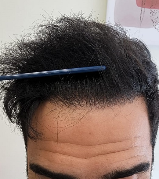 7. After Front.jpg
