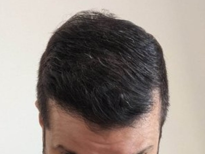 7. After Top.jpg