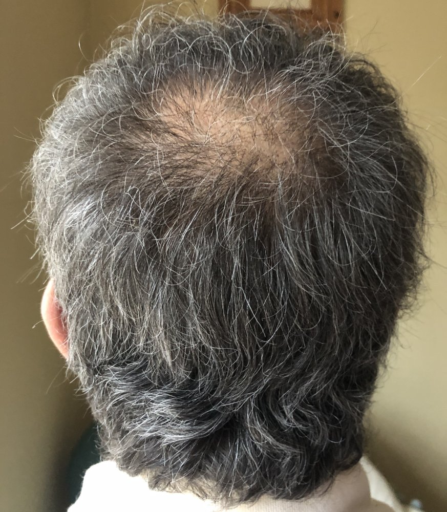 7 months_3337.JPG