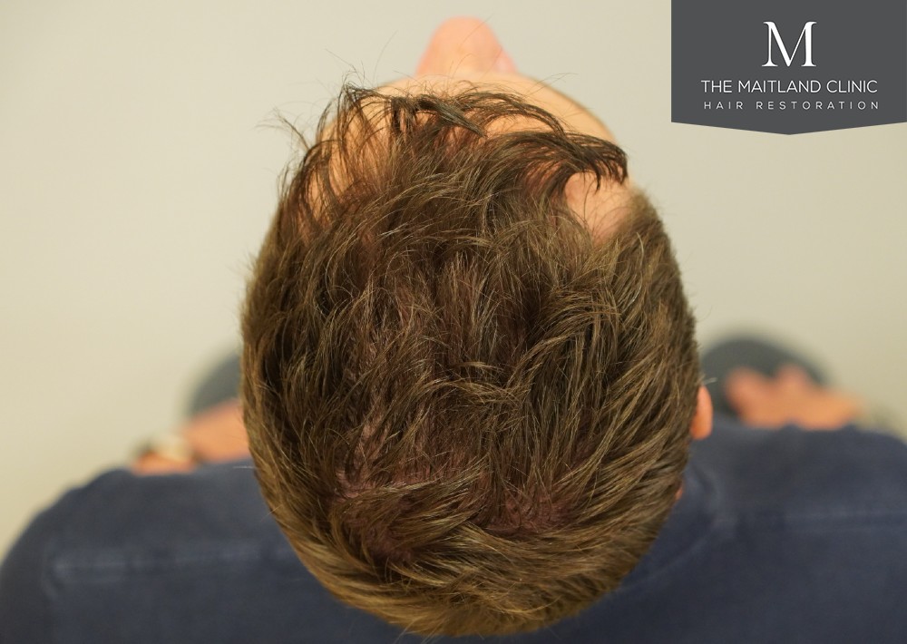 7B0A08A5-70AB-4D94-927A-D3BAB6DB4013.jpeg
