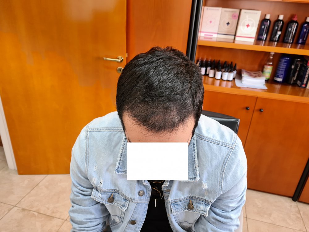 8. 3 months after.jpg
