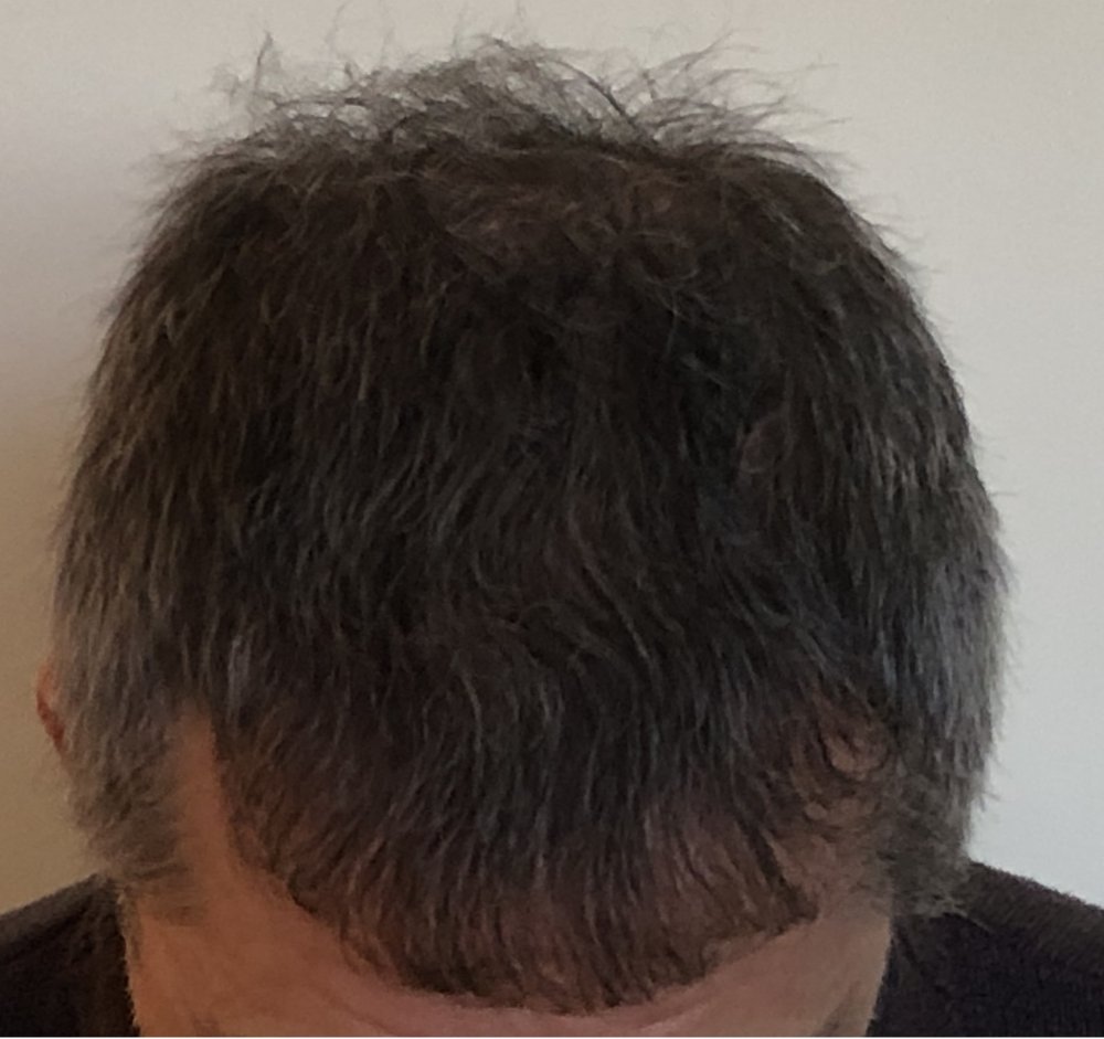 8.5 months 3686.JPG