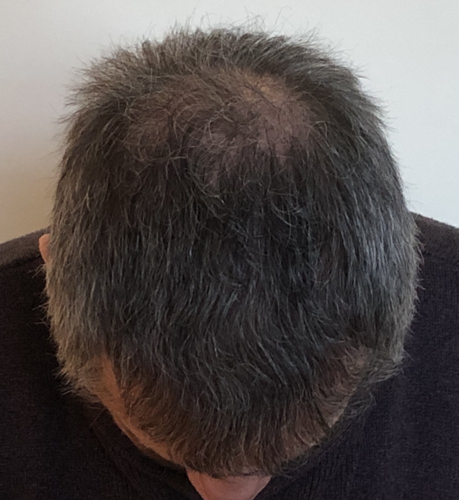 8.5 months 3687.JPG