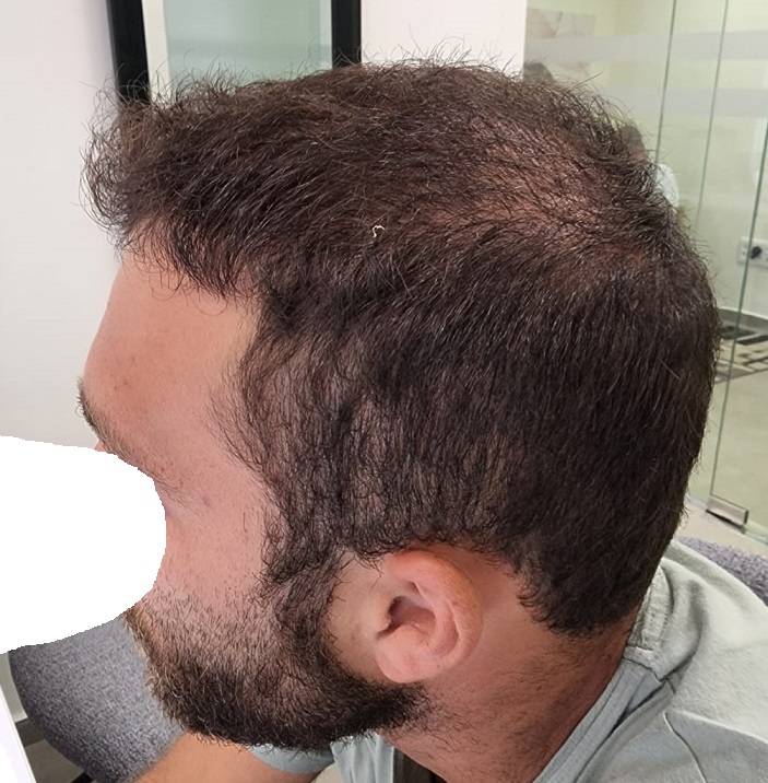 8. 6.5 Months After.jpg