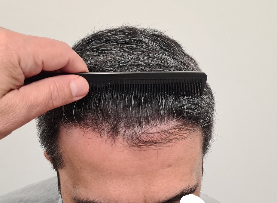 8. 6 Months HL front.jpg